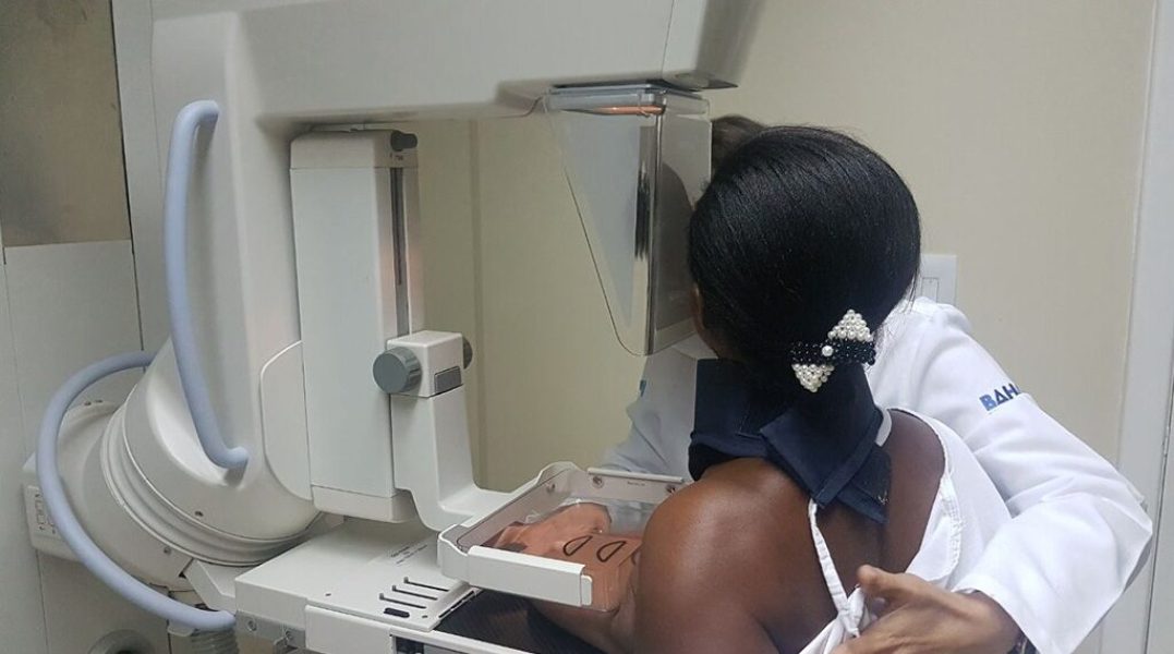 Mamografia_Secom_Bahia-1024×570-1 Mamografia_Secom_Bahia-1024x570-1