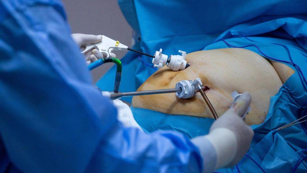 Novas-regras-do-CFM-ampliam-criterios-para-cirurgia-bariatrica